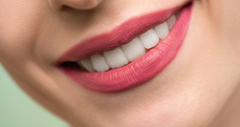 4 lucruri pe care trebuie sa le stii despre albirea dentara